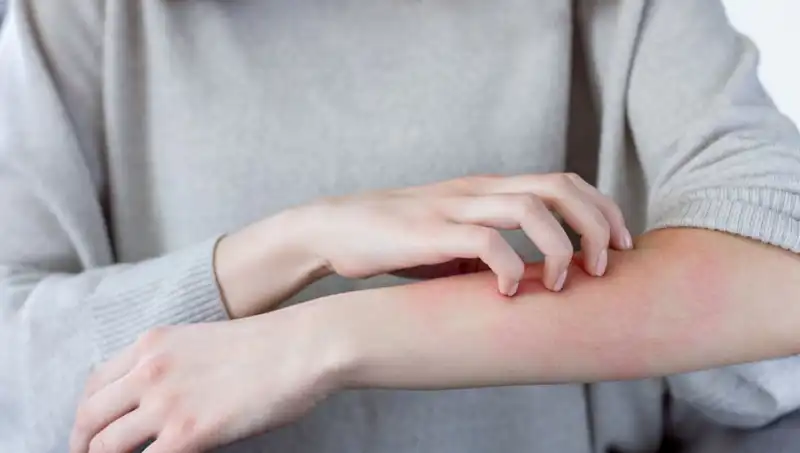 Cilt Kanserinin Sinyalleri: Dermatologdan Önemli İpuçları